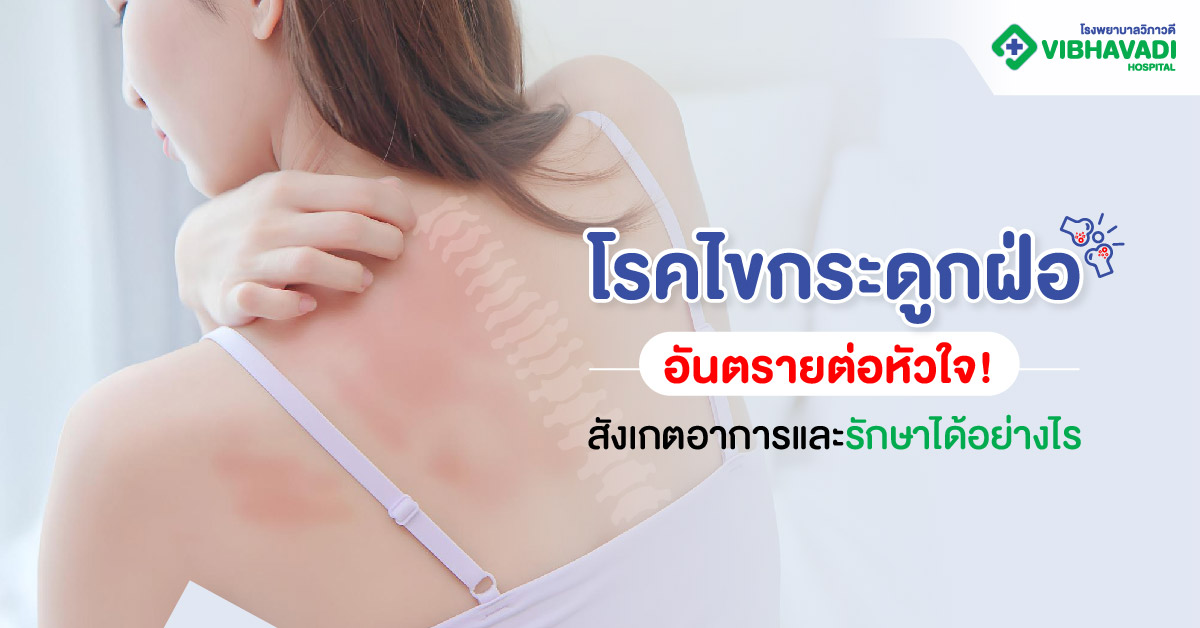 โรคไขกระดูกฝ่อ