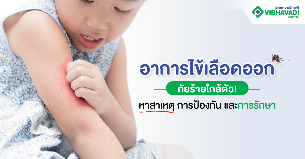 ไข้เลือดออก