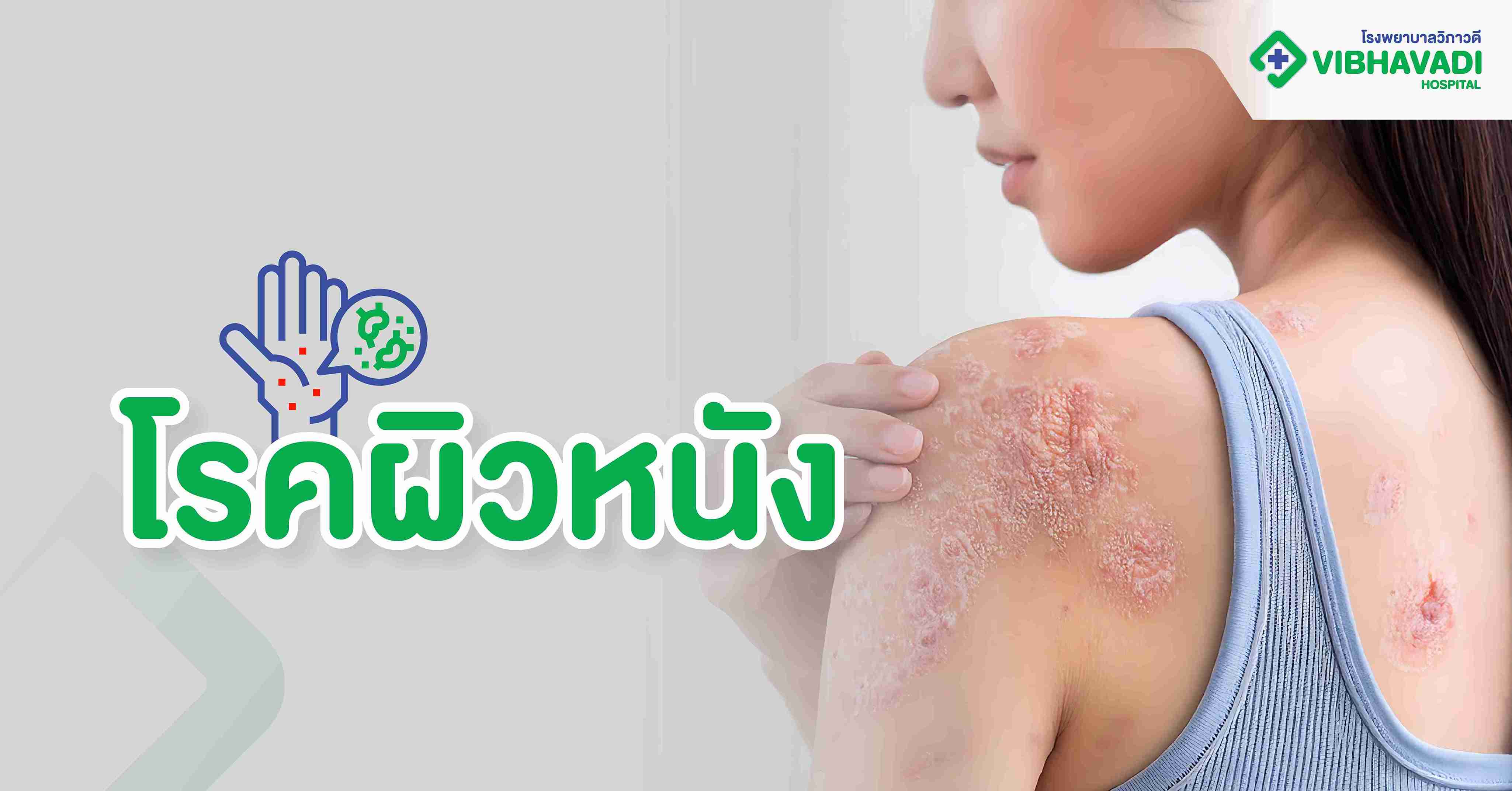 โรคผิวหนัง