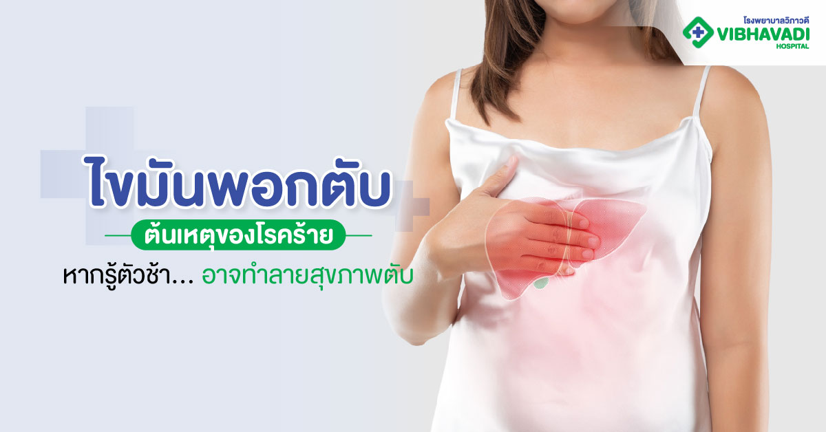 ไขมันพอกตับ