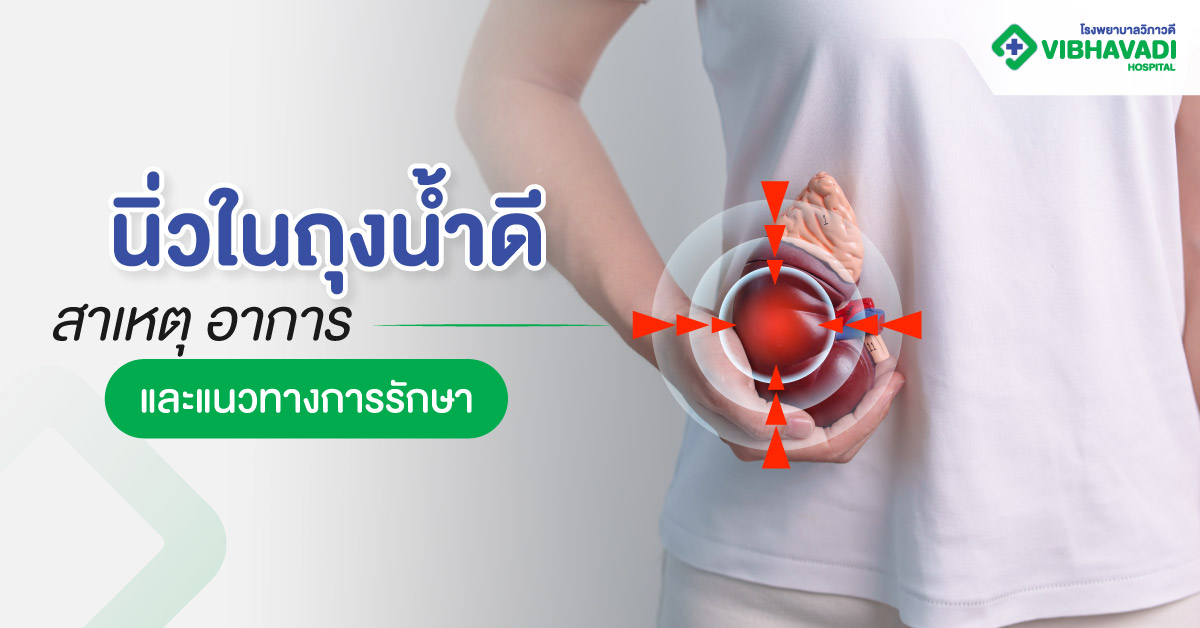 นิ่วในถุงน้ำดี