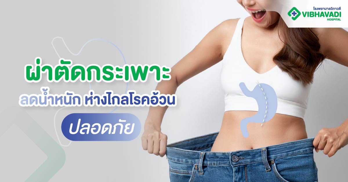 ผ่าตัดกระเพาะ