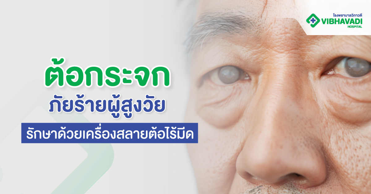 ต้อกระจก: ภัยร้ายผู้สูงวัย