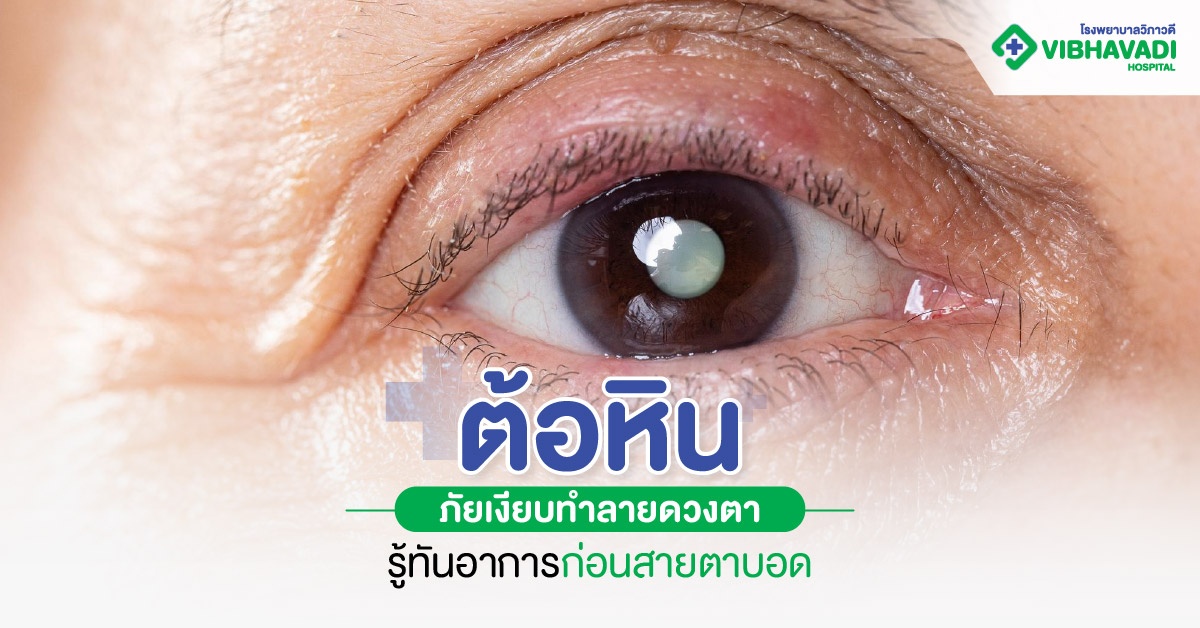 ต้อหิน: ภัยเงียบทำลายดวงตา