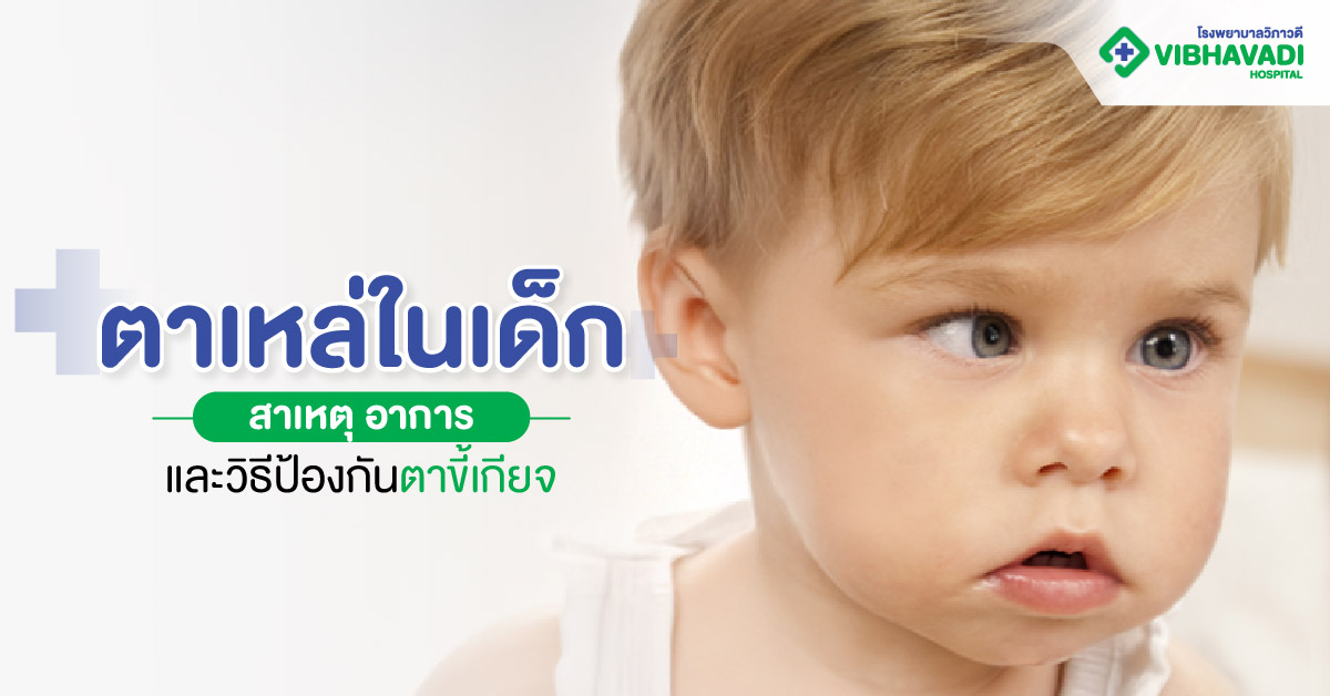 ตาเหล่ในเด็ก: สาเหตุ อาการ และวิธีป้องกันตาขี้เกียจ