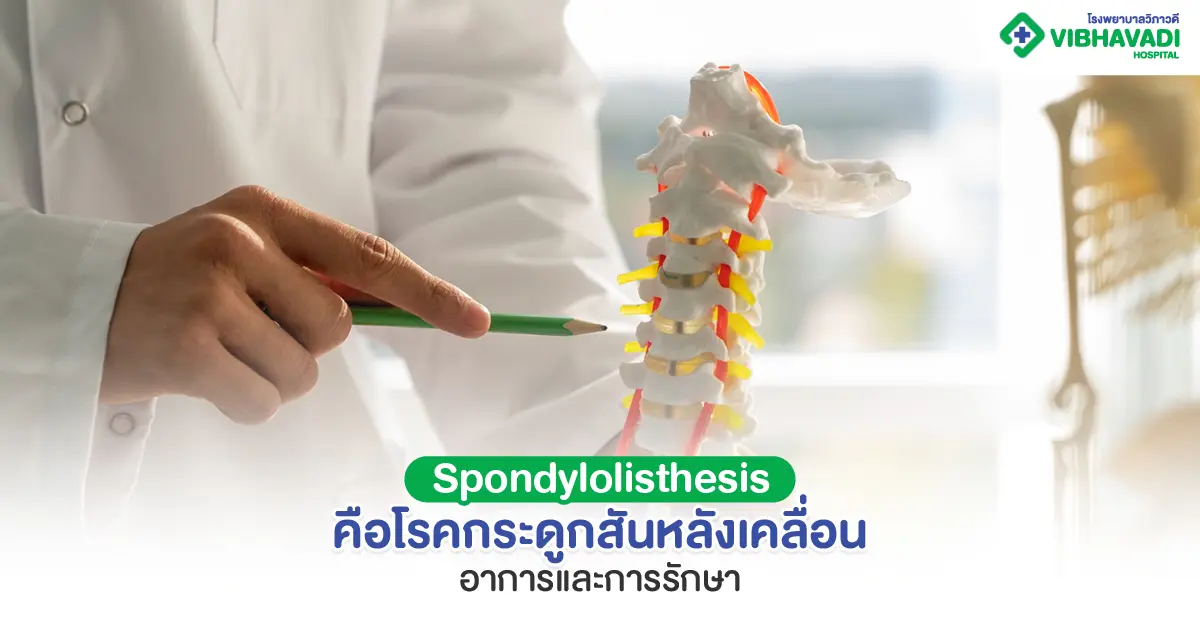 Spondylolisthesis คืออะไร โรคกระดูกสันหลังเคลื่อนอันตรายไหม
