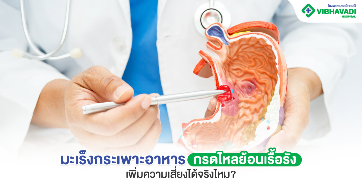 มะเร็งกระเพาะอาหาร กรดไหลย้อนเรื้อรัง เพิ่มความเสี่ยงแค่ไหน?