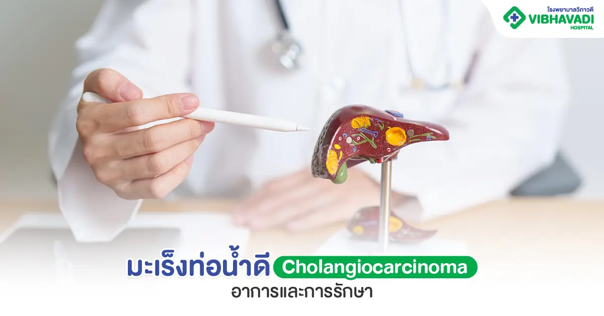 มะเร็งท่อน้ำดี สังเกตอาการอย่างไร มีวิธีการรักษาได้อย่างไร