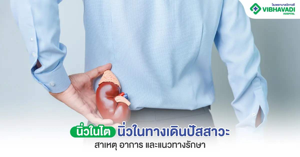 นิ่วในไต นิ่วในทางเดินปัสสาวะ สาเหตุ อาการ และแนวทางรักษา