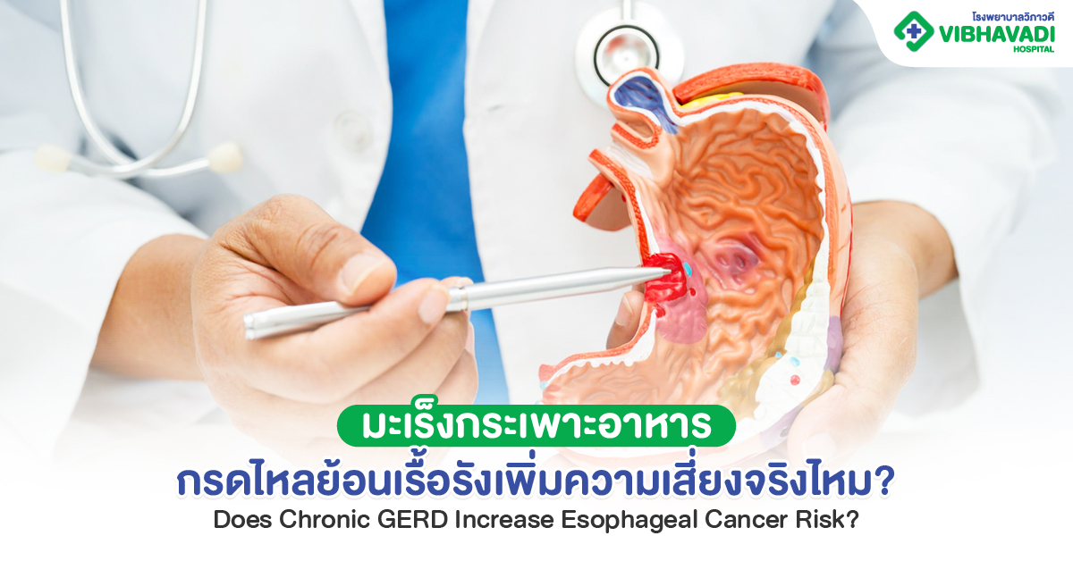Stomach Cancer and Chronic Acid Reflux: Can Long-Term Acid