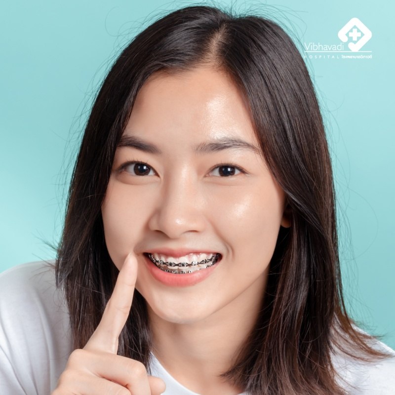 Understanding Orthodontic Treatment: Types, Advantages, Disadvantages, and How to Prepare for Spending Money