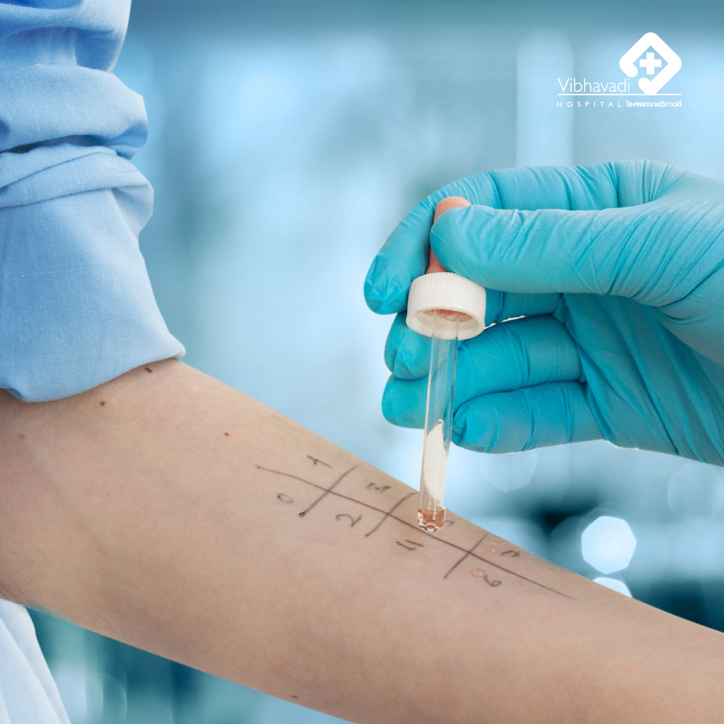Allergy Skin Testing