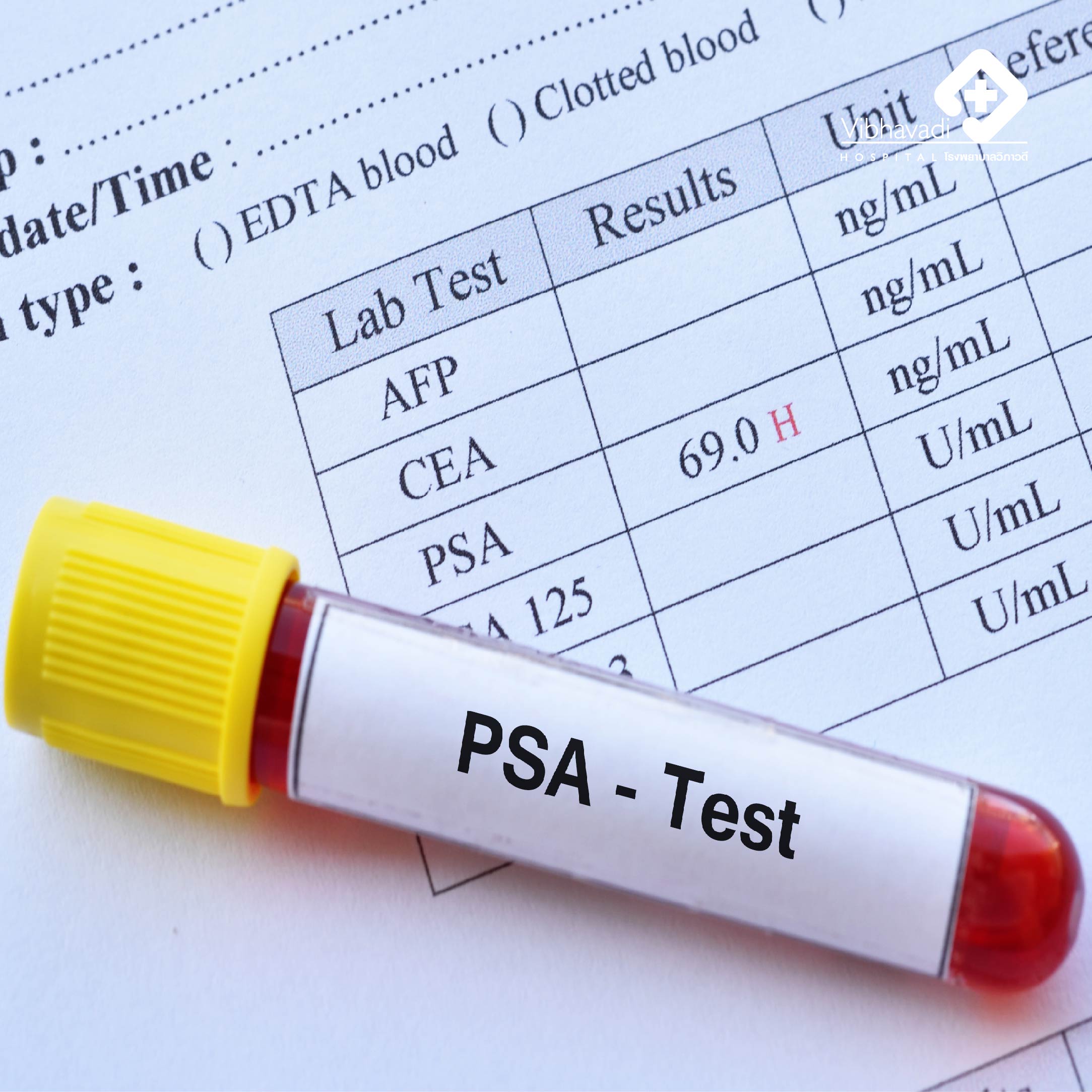 What PSA value is deemed abnormal?