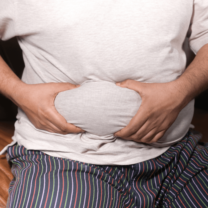 การผ่าตัดไขมันหน้าท้อง (Abdominal Lipectomy and Abdominoplasty;Tummy Tuck Surgery)
