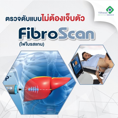 Fibro Scan ตรวจตับแบบไม่ต้องเจ็บตัว