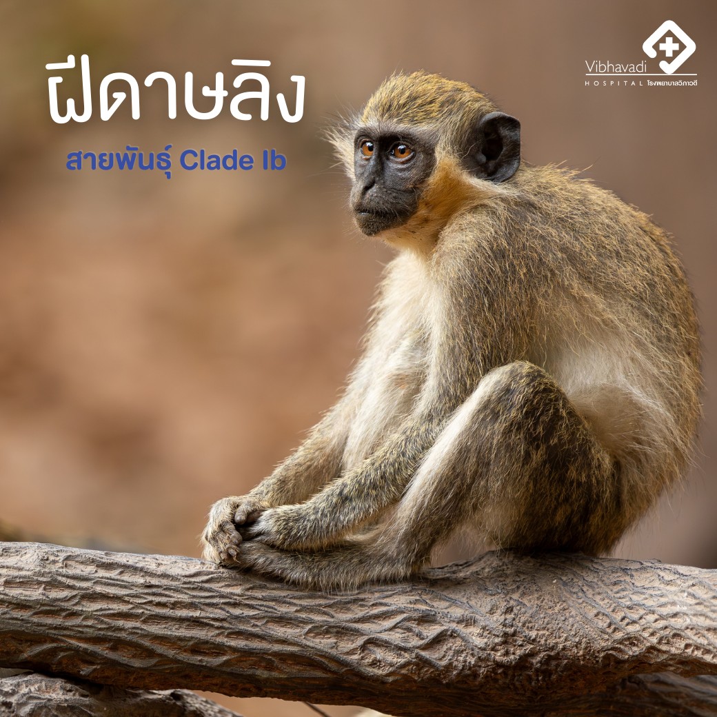 Monkeypox