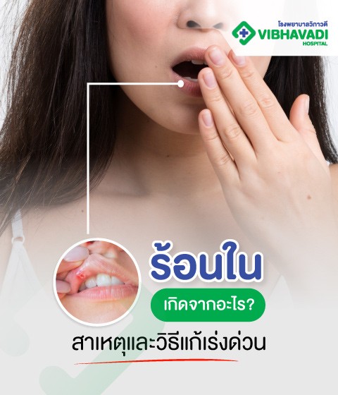 Mouth Ulcer Causes