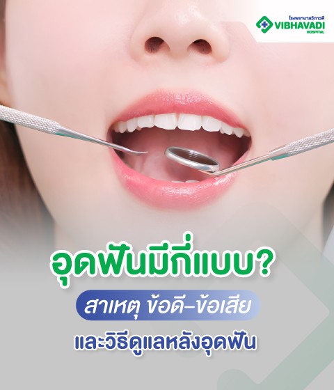 อุดฟันมีกี่แบบ? สาเหตุ ข้อดี–ข้อเสีย และวิธีดูแลหลังอุดฟัน