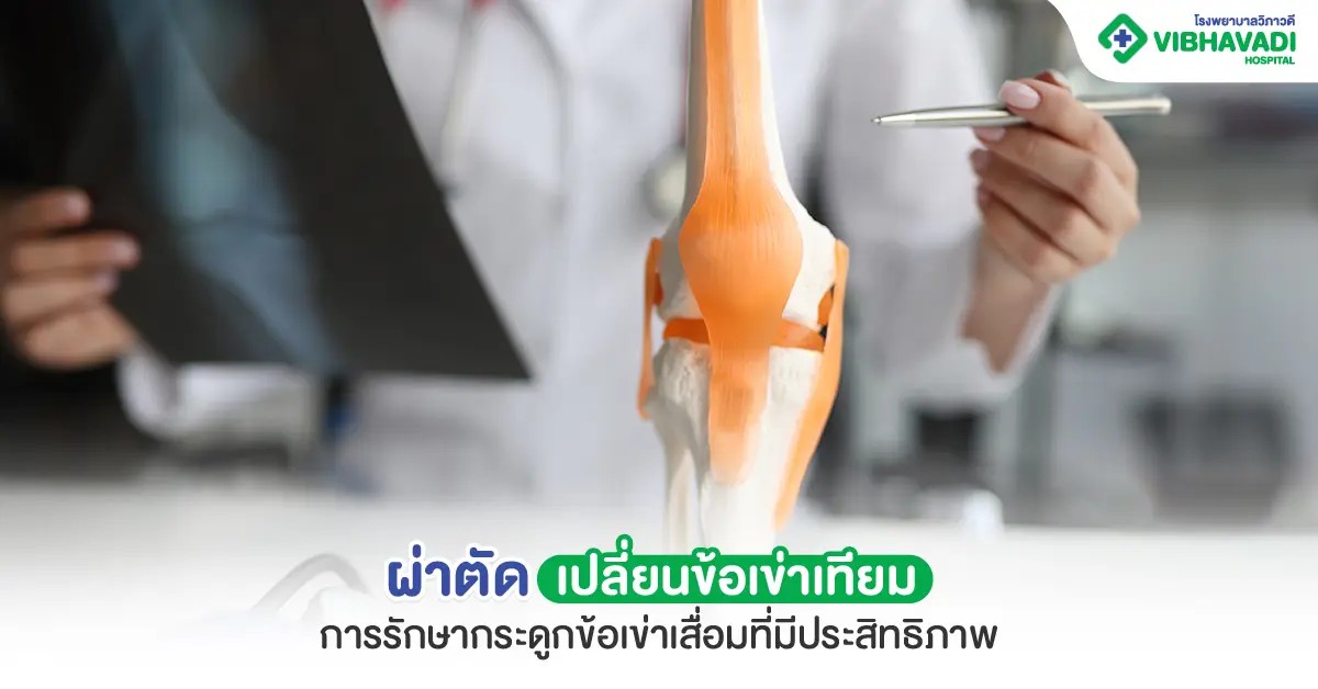 ผ่าตัดเปลี่ยนข้อเข่าเทียม ทางเลือกการรักษากระดูกข้อเข่าเสื่อ