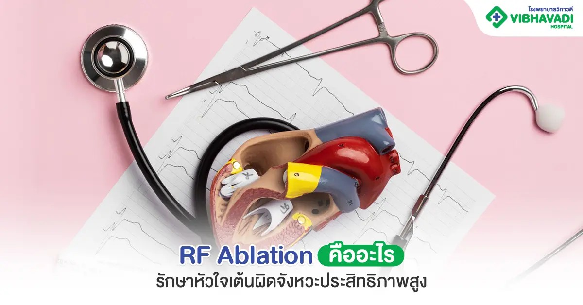 What is RF Ablation? Highly effective treatment for irregular heartbeat