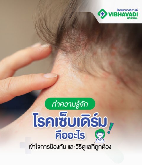 What is seborrheic dermatitis and how to manage it?