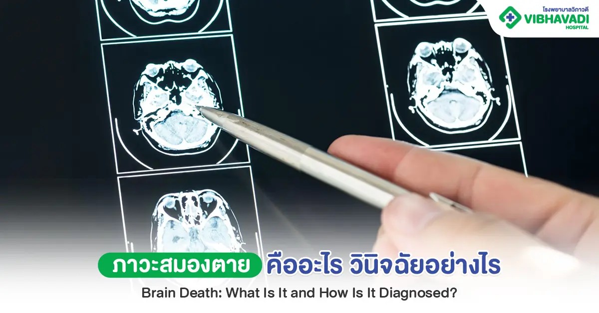 ภาวะสมองตายคืออะไร? สาเหตุ อาการ และการวินิจฉัย