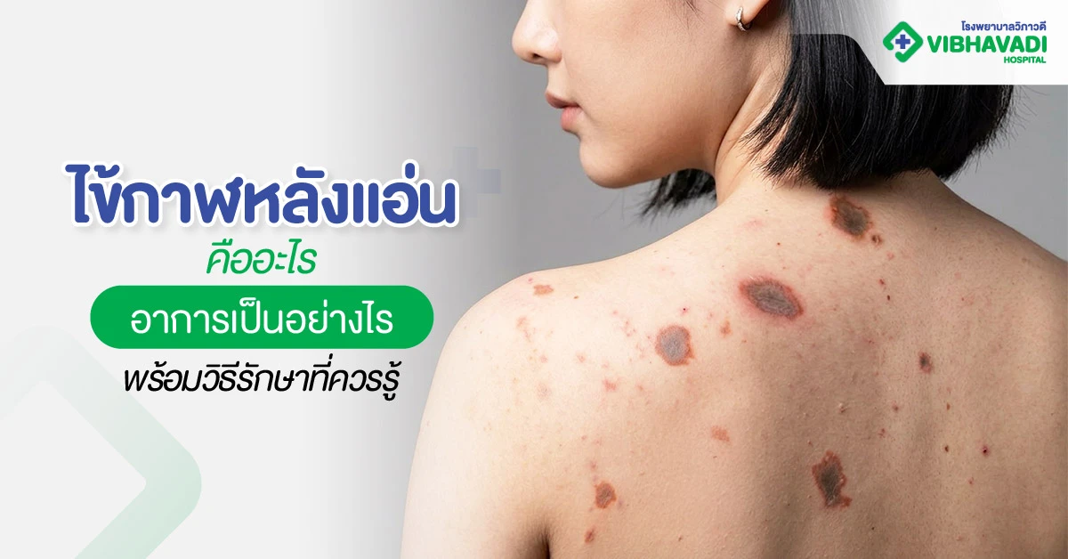What is meningococcal meningitis?