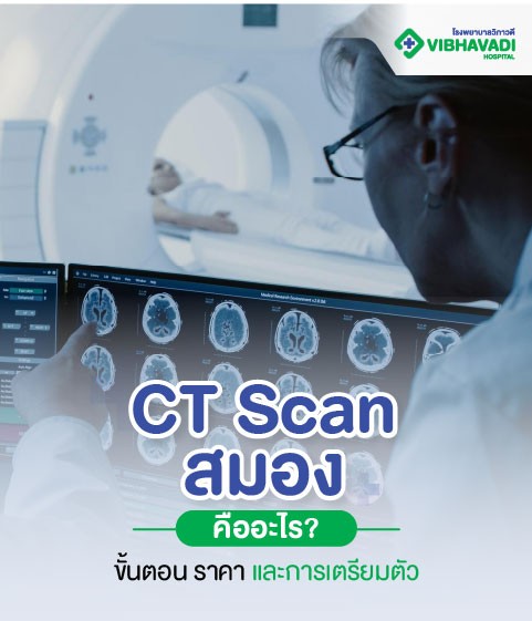 CT Scan สมอง ตรวจหาความผิดปกติของสมอง