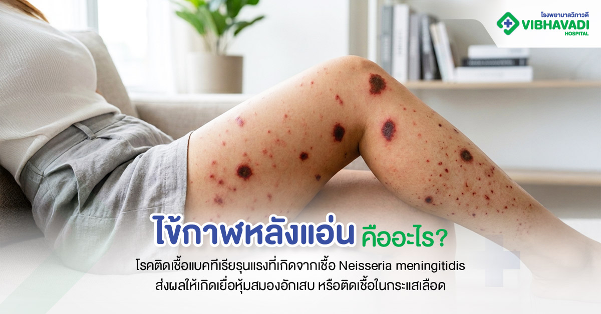 ไข้กาฬหลังแอ่นคืออะไร