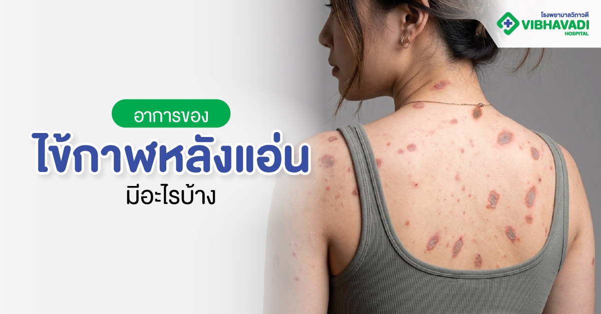 อาการของไข้กาฬหลังแอ่นมีอะไรบ้าง