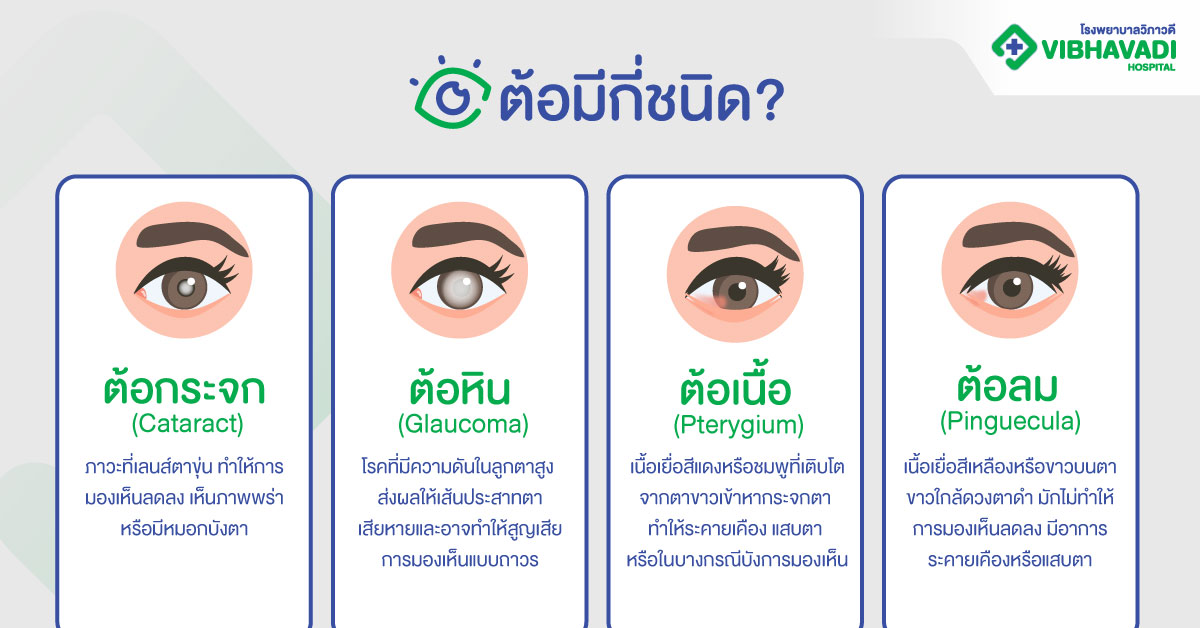 ต้อมีกี่ชนิด