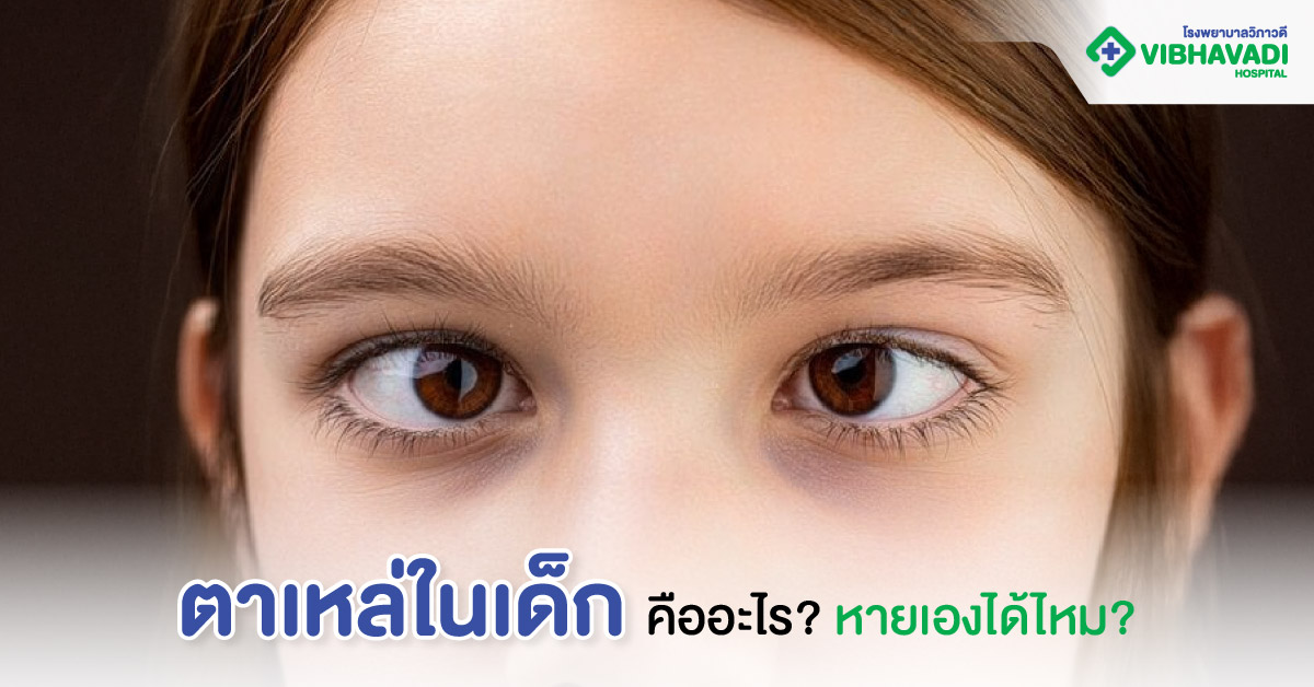 ตาเหล่ในเด็กคืออะไร หายเองได้ไหม
