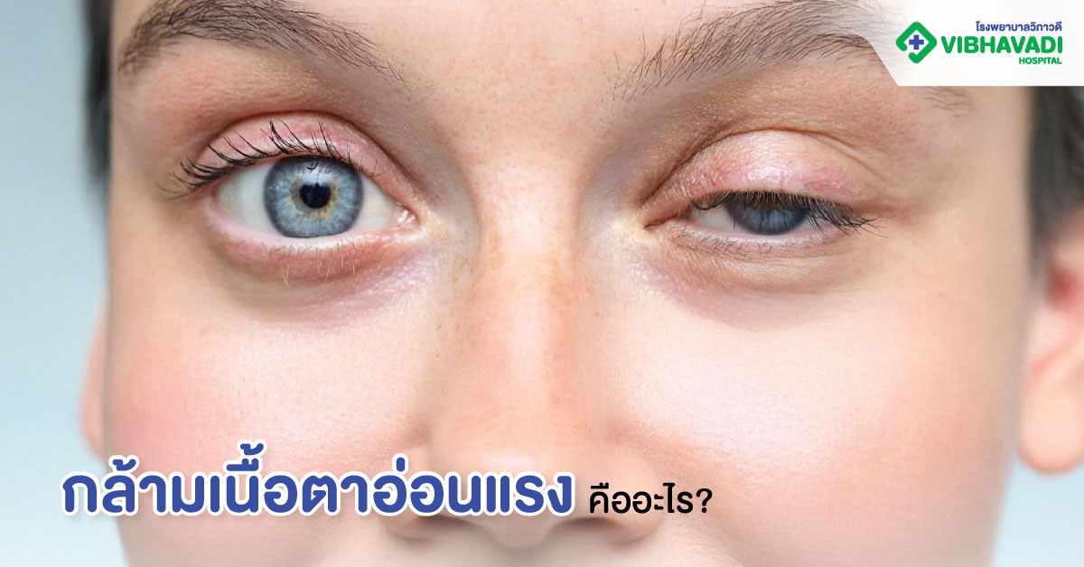 กล้ามเนื้อตาอ่อนแรงคืออะไร