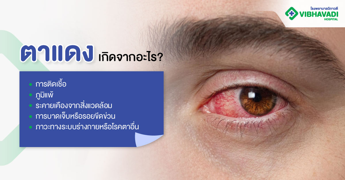 ตาแดงเกิดจากอะไร