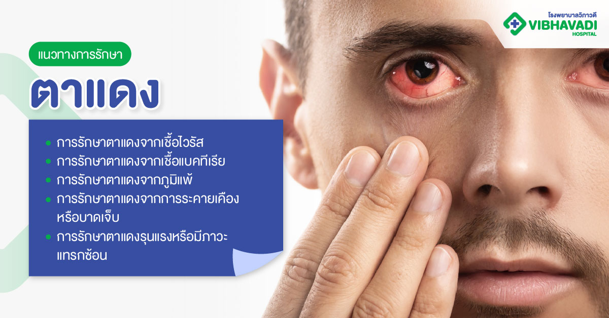 แนวทางการรักษาตาแดง