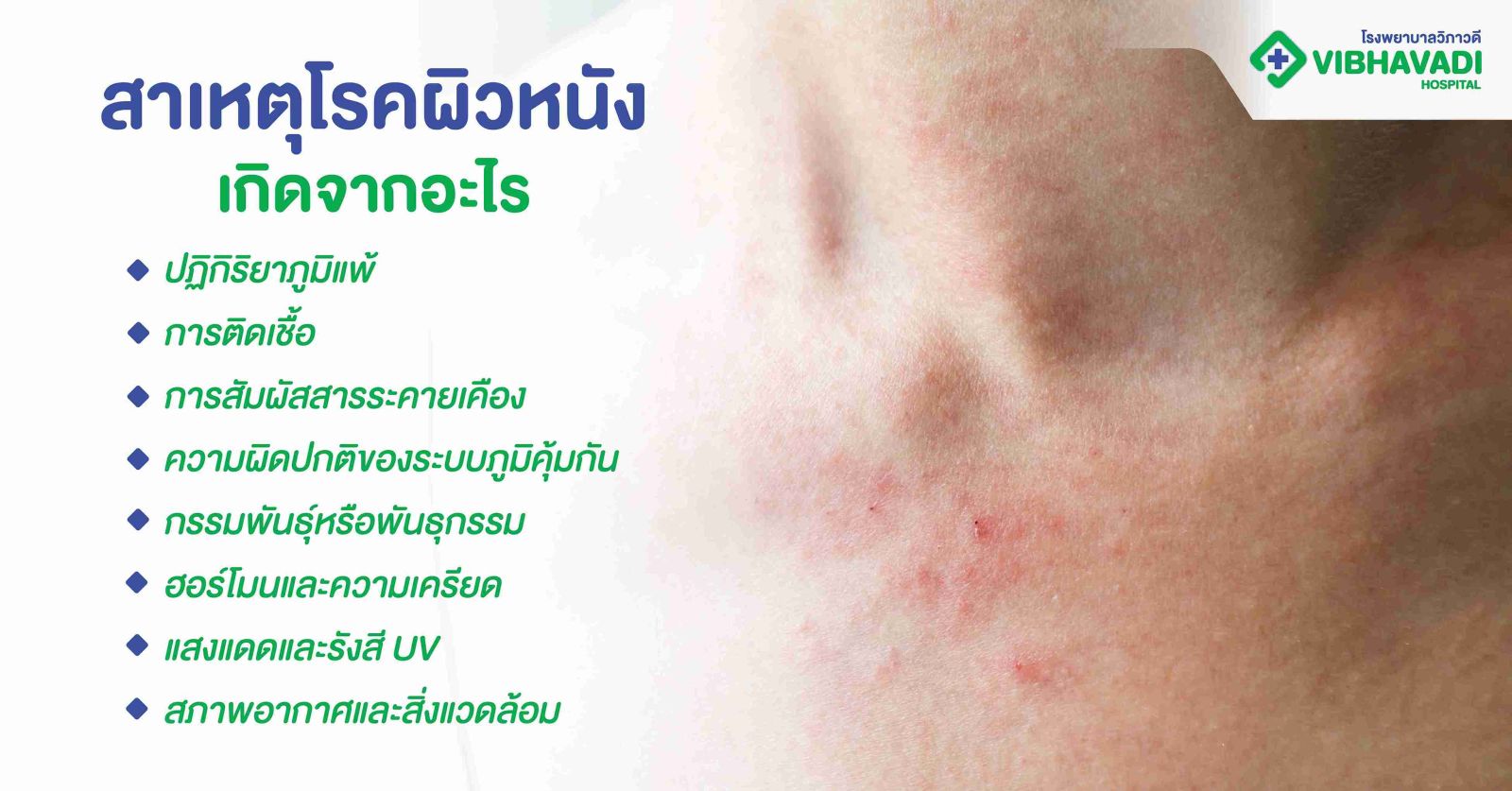 สาเหตุโรคผิวหนังเกิดจากอะไร