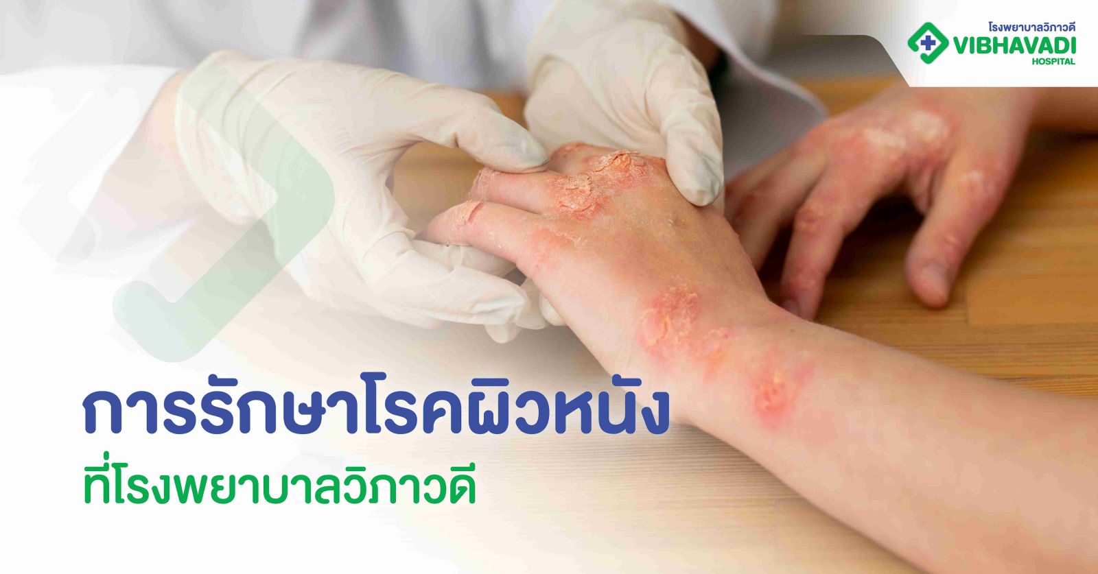 การรักษาโรคผิวหนัง ที่โรงพยาบาลวิภาวดี