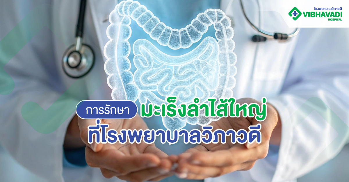 การรักษามะเร็งลำไส้ใหญ่ ที่โรงพยาบาลวิภาวดี