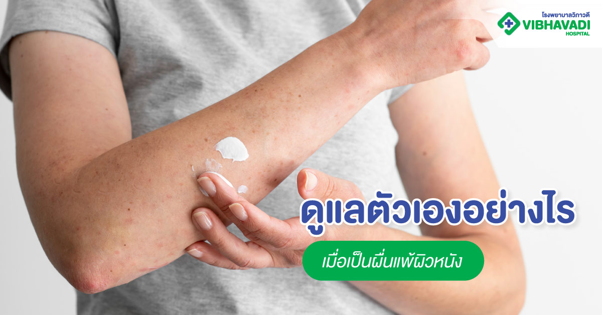 ดูแลตัวเองอย่างไร เมื่อเป็นผื่นแพ้ผิวหนัง