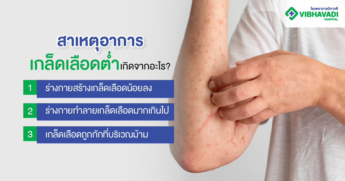 หาสาเหตุอาการเกล็ดเลือดต่ำ เกิดจากอะไร