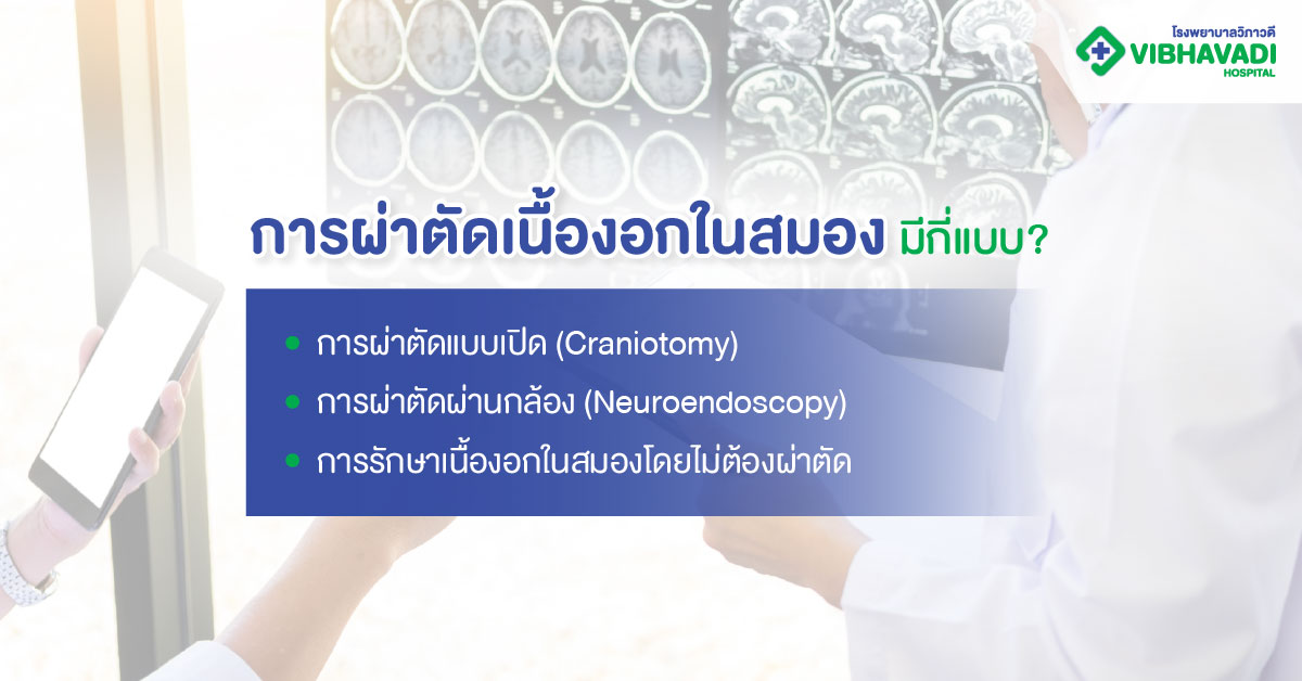 การผ่าตัดเนื้องอกในสมอง มีกี่แบบ?