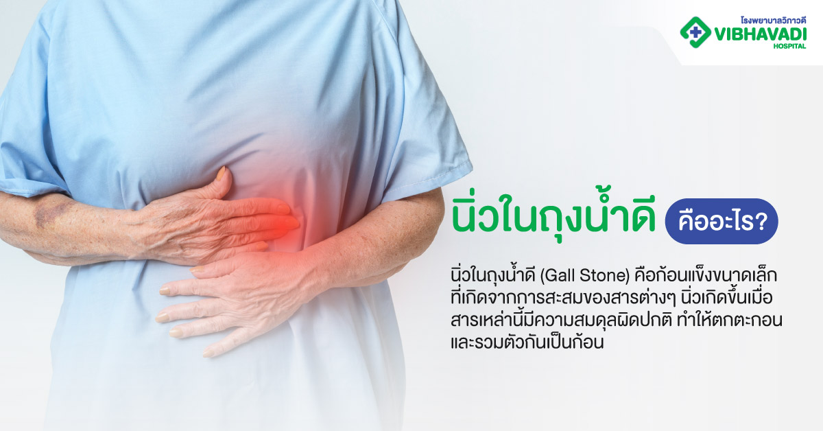 นิ่วในถุงน้ำดี คืออะไร?