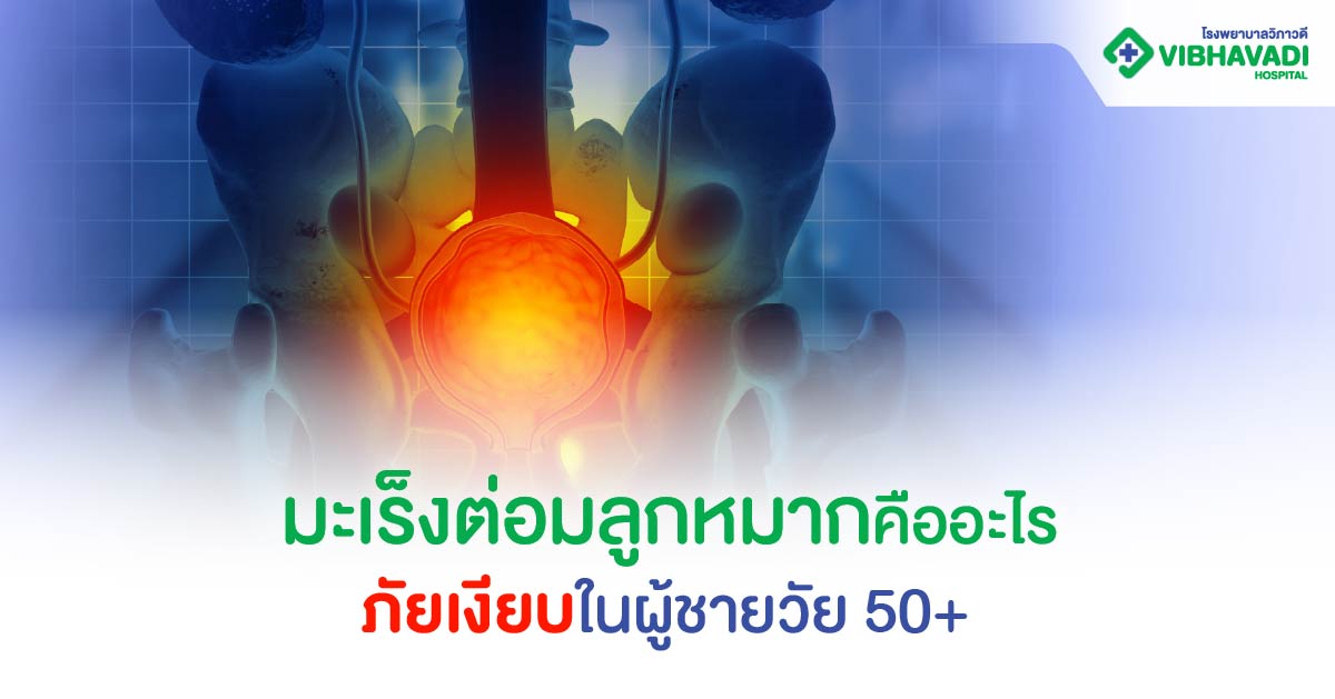 มะเร็งต่อมลูกหมากคืออะไร ภัยเงียบในผู้ชายวัย 50+
