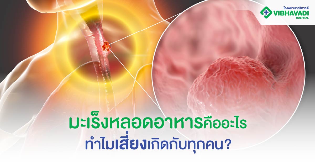 มะเร็งหลอดอาหารคืออะไร ทำไมเสี่ยงเกิดกับทุกคน?