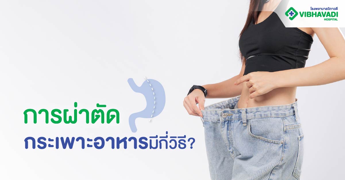 การผ่าตัดกระเพาะอาหารมีกี่วิธี