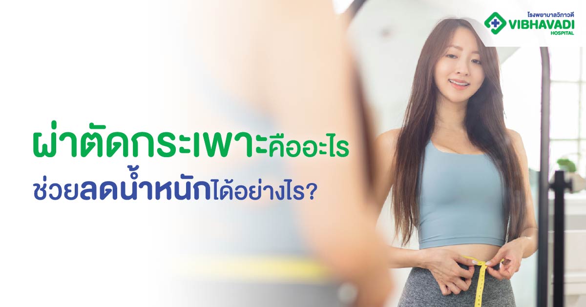ผ่าตัดกระเพาะคืออะไร ช่วยลดน้ำหนักได้อย่างไร