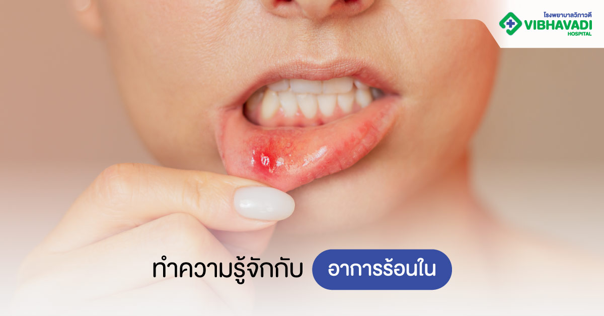 ทำความรู้จักกับอาการร้อนใน