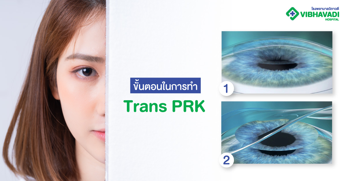 ขั้นตอนในการทำ Trans PRK