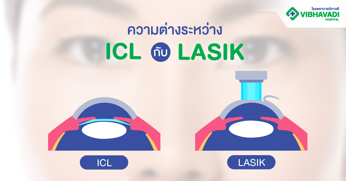 ความต่างระหว่าง ICL กับ LASIK