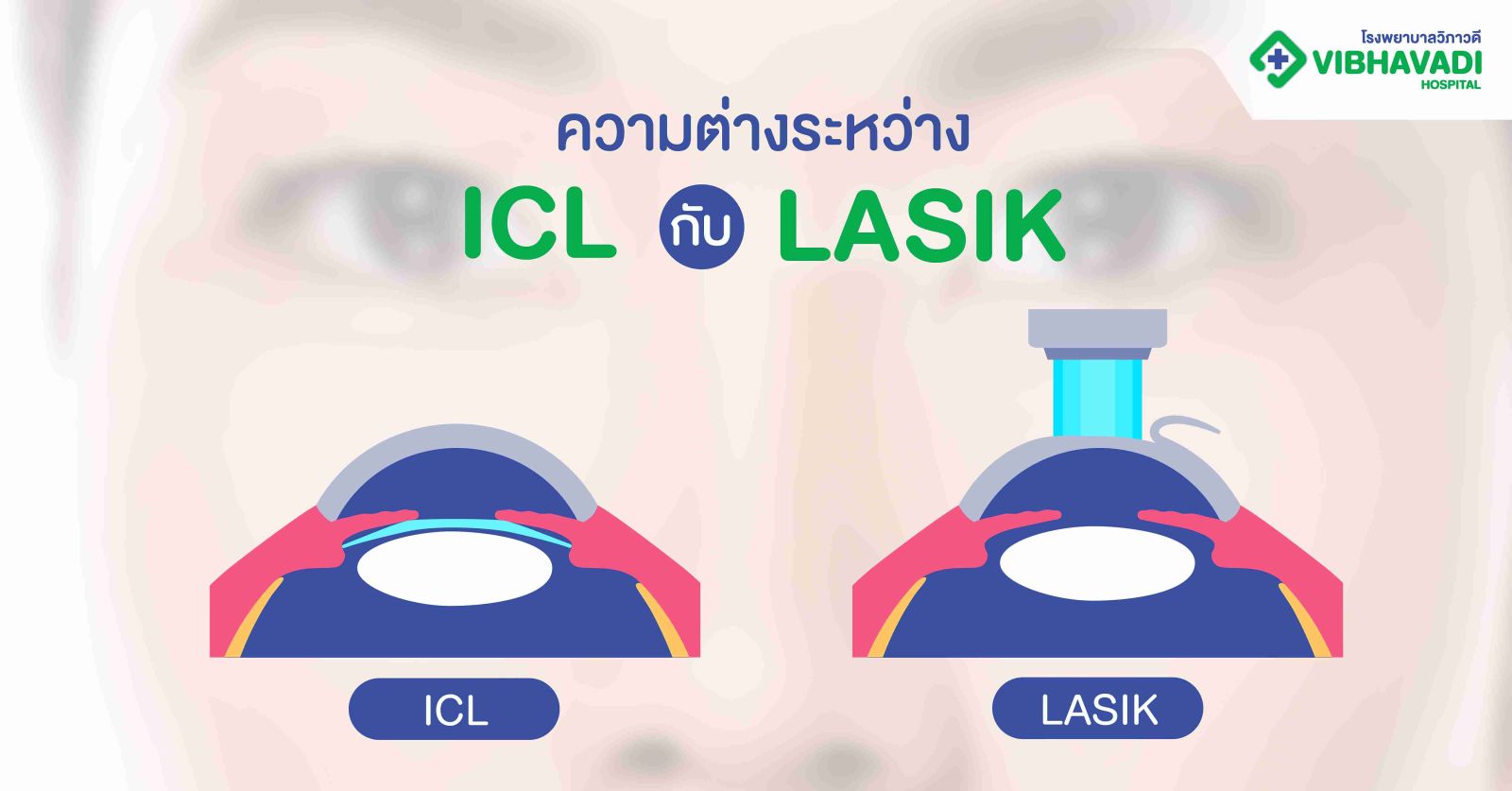 ความต่างระหว่าง ICL กับ LASIK